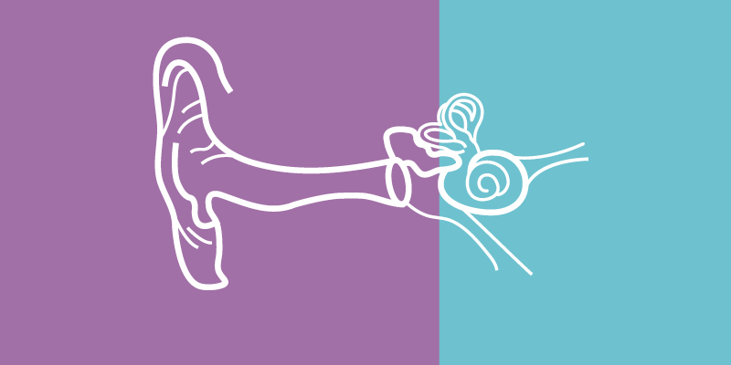 Above: Conductive Hearing Loss affected area (purple), Sensorineural Hearing Loss affected area (blue).